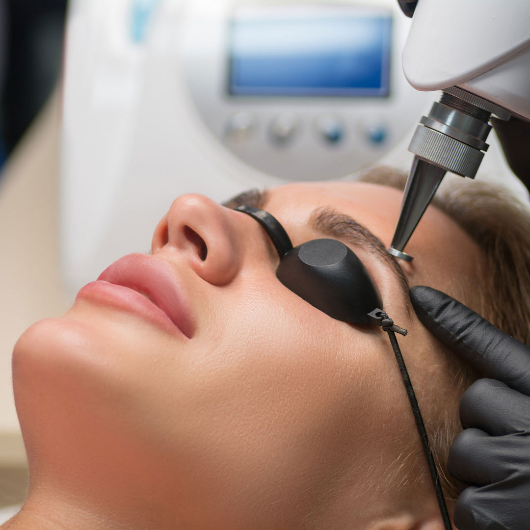 Brow Tattoo Removal