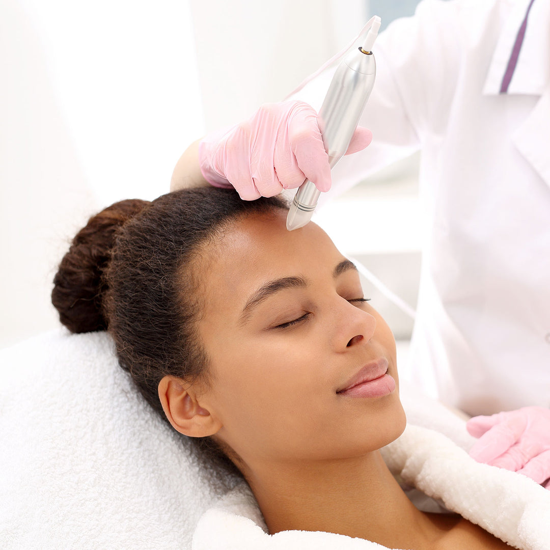 Microneedling
