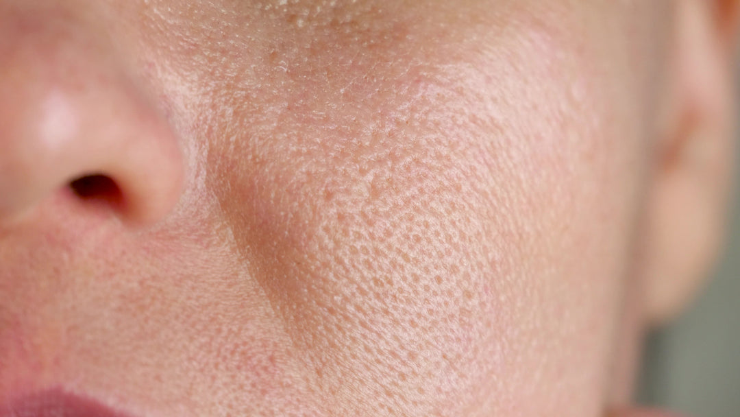 Pico Focus Facial