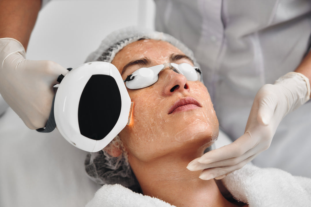 IPL (Intense Pulsed Light)